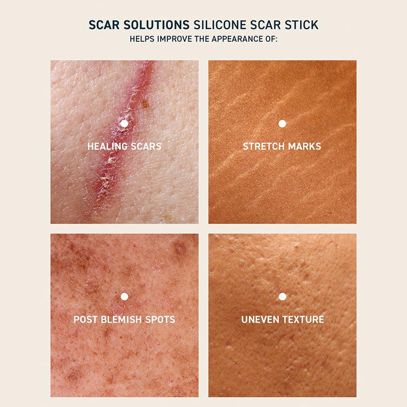 Gentle Silicone Scar Stick – Nourishing & Smoothing Balm for Facial Skin