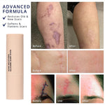 Gentle Silicone Scar Stick – Nourishing & Smoothing Balm for Facial Skin