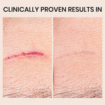 Gentle Silicone Scar Stick – Nourishing & Smoothing Balm for Facial Skin